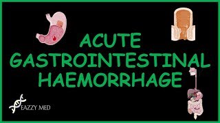 Acute Gastrointestinal Bleeding causesfeaturesdiagnosis and treatment [upl. by Liarret803]