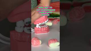 How NOT to eat WATERMELON CANDY with BRACES what to eat instead braces watermelon candy [upl. by Godiva]