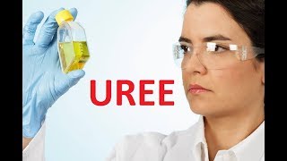 Urée urée élevée et urée basse [upl. by Drahser]