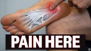 Plantar Fasciitis Education  Myths  Stretching amp Strengthening Exercises [upl. by Milurd]