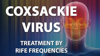 Coxsackie Virus  RIFE Frequencies Treatment  Energy amp Quantum Medicine with Bioresonance [upl. by Drescher]