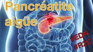 Pancréatite aigüe  fiche de révision de litem 358 de lEDN [upl. by Cochran213]