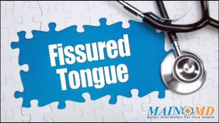 Fissured Tongue ¦ Treatment and Symptoms [upl. by Attenaej]