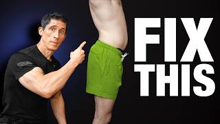 How To Fix Anterior Pelvic Tilt FOREVER [upl. by Grewitz]