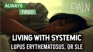 Systematic Lupus Erythematosus SLE I Signs and Symptoms  How to Deal with Living with SLE [upl. by Tadashi]