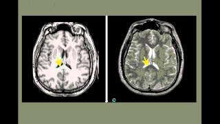 Neuroanatomia por imagenes [upl. by Saihttam]