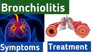 Bronchiolitis breathing  bronchiolitis cough symptoms causes diagnosis and treatment bronchitis [upl. by Noivaz]