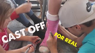 CAST COMES OFF PERMANENTLY FOR TEN YEAR OLD WHO HAD MAJOR SURGERY  NO MORE CAST FOREVER [upl. by Eimoan]