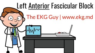 Left Anterior Fascicular Block on EKG  ECG l The EKG Guy  wwwekgmd [upl. by Uos]