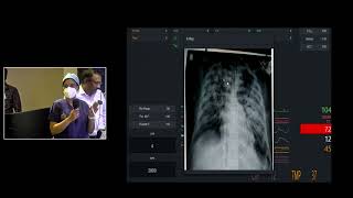 ECMO troubleshooting [upl. by Jezabella]