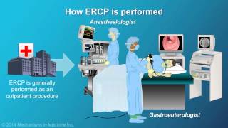 Understanding ERCP Endoscopic Retrograde Cholangiopancreatography [upl. by Llevram]