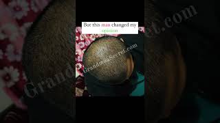 These Hair growth results will shock you 😲 haircare hairgrowth hair [upl. by Inanuah]