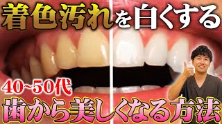 【歯から美しくなる方法】40〜50代の歯の着色汚れ！今からでも間に合う！歯を綺麗にする方法を教えます！ [upl. by Sillyhp868]