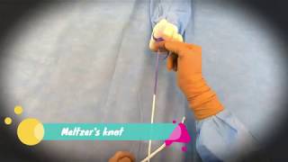 Laparoscopic Meltzers Knot [upl. by Peltz]