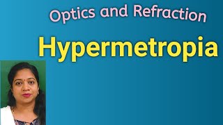 HYPERMETROPIADefinitionOptical diagramMechanismClassificationSymptoms Signs Treatment [upl. by Ztnaj221]