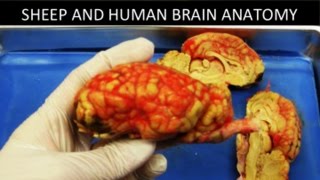 Sheep Brain Dissection [upl. by Brande]