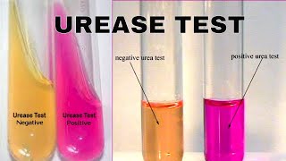 Urea Hydrolysis Urease Test [upl. by Maurilla]