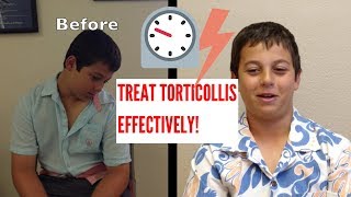 Effective Torticollis Treatment INCREDIBLE RESULTS [upl. by Irtimed]