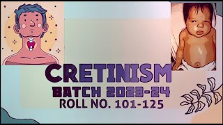 Cretinism [upl. by Kannry]