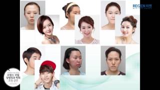 REGEN Plastic Surgery Korea French society of Plastic Surgery [upl. by Marlyn]