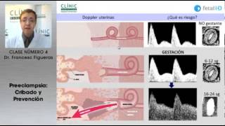 Preeclampsia cribado y prevención [upl. by Eadahs]