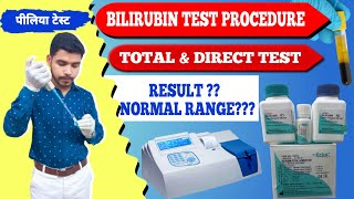 Total amp Direct Bilirubin test procedure practical video पीलिया टेस्टjaundice testserum bilirubin [upl. by Eojyllib]