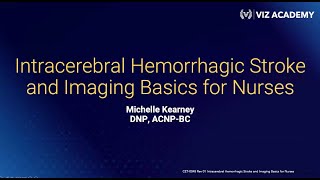 Intracerebral Hemorrhage Stroke and Imaging Basics for Nurses [upl. by Lamiv]