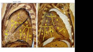 Bronchopulmonary segments of the lungs [upl. by Artemis]