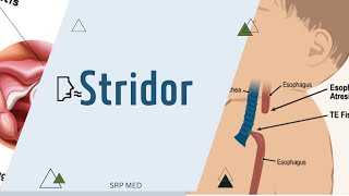 StridorDefinitionTypesMechanism [upl. by Cristian]