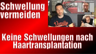 Schwellungen nach Haartransplantation Erfahrung dicker Kopf Hilfe Haarverpflanzung Schwellungen [upl. by Tiffi654]