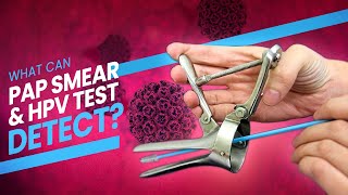 Pap Smear Pap Test and HPV Test  A step by step guide 3D at what happens during the test [upl. by Airamanna867]