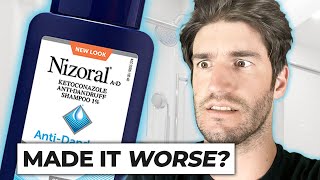 Ketoconazole shampoo  Is it worth using for hair loss [upl. by Glavin]