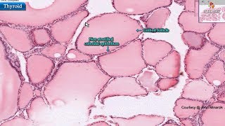 Histology of thyroid gland  Shotgun Histology [upl. by Ynnelg]