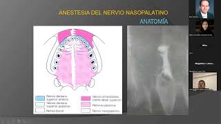 Técnicas anestésicas complejas en odontología [upl. by Magdalena]