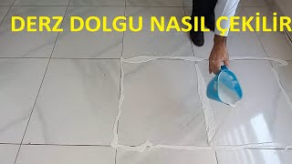 GÜLÜŞ ÇİZGİSİ DOLGUSUYLA YORGUN GÖRÜNTÜM GİTTİ [upl. by Collayer]