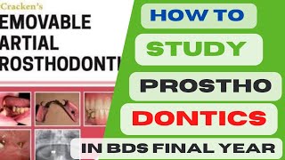 How to Study Prosthodontics in BDS final YearImportant topics of prosthodonticspast papers prostho [upl. by Arbas]