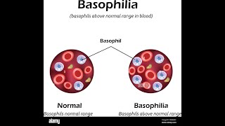 Basophilia Symptoms and Causes  Diagnosis  Treatment  Prevention [upl. by Alle252]