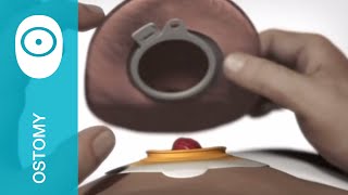 Applying a 2piece SenSura Click urostomy pouch [upl. by Rieger]