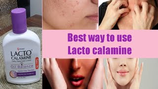 Lecto Calamine Lotion UsesBest 5 Way to Use On SkinNo More Dry pigmentedItcy Skin [upl. by Ruddie]