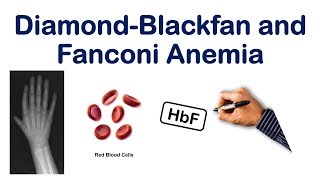 Diamond Blackfan and Fanconi Anemia Mnemonic  USMLE STEP NCLEX COMLEX [upl. by Carlisle]