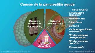 Pancreatitis aguda [upl. by Mascia]