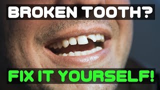 BROKEN TOOTH FIX IT YOURSELF WITH TEMPTOOTH diyfixbrokentooth fixtooth [upl. by Atnahs]