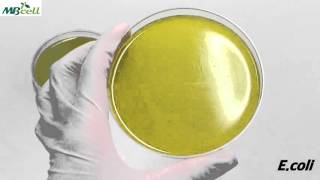 Bacillus Cereus Agar [upl. by Isabel]