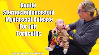 Gentle Sternocleidomastoid Myofascial Release LeftSided Torticollis Treatment in Babies 042L [upl. by Neehs]