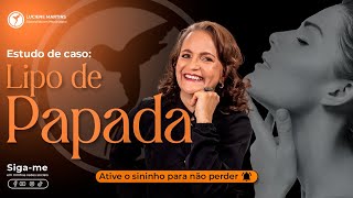 Estudo de caso PoÌs lipo de Papada [upl. by Sholeen517]