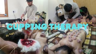 Home 🏠 Visit Cupping❤️Therapy  Dr Tushar Dhingaan  wellness physio clinic [upl. by Derrek]