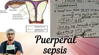 Puerperal sepsis part 1 [upl. by Leiba]