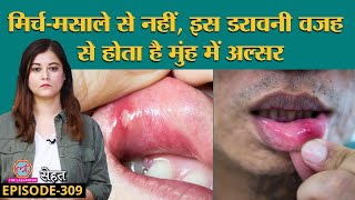 Mouth Ulcer यानी मुंह में छाले क्यों हो जाते हैं कैसे ठीक करें जानें Doctors से  Sehat ep 309 [upl. by Gaylord868]