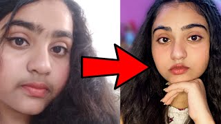 Teenage Facial Hair Removal with total Natural Ingredients How I removed my Facial Hairs Naturally [upl. by Koby]