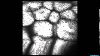 Confocal Endomicroscopy of the Stomach Gastritis Int Metaplasia Adenoma and Gastric Cancer [upl. by Lithea]